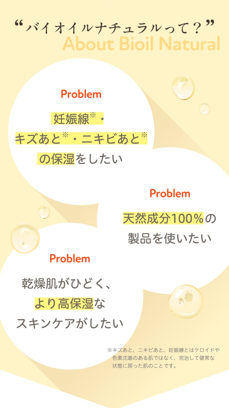 バイオイルナチュラルって？：妊娠線※・キズあと※・ニキビあと※の保湿をしたい／天然成分100％の製品を使いたい／乾燥肌がひどく、より高保湿なスキンケアがしたい※キズあと、ニキビあと、妊娠線とはケロイドや色素沈着のある肌ではなく、完治して健常な状態に戻った肌のことです。