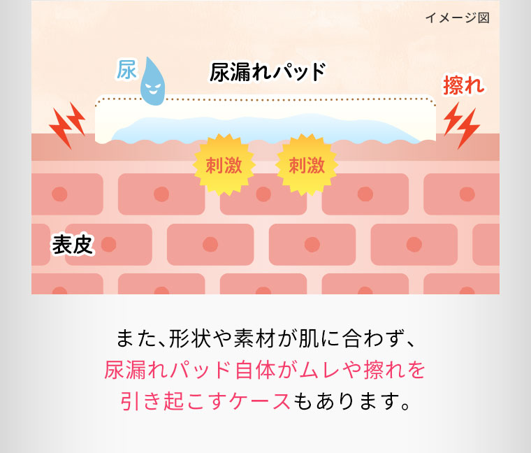 また、形状や素材が肌に合わず、尿漏れパッド自体がムレや擦れを引き起こすケースもあります。