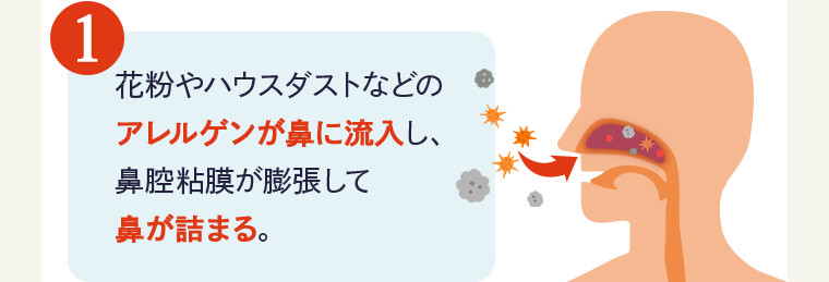 ①花粉やハウスダストなどのアレルゲンが鼻に流入し、鼻腔粘膜が膨張して鼻が詰まる。