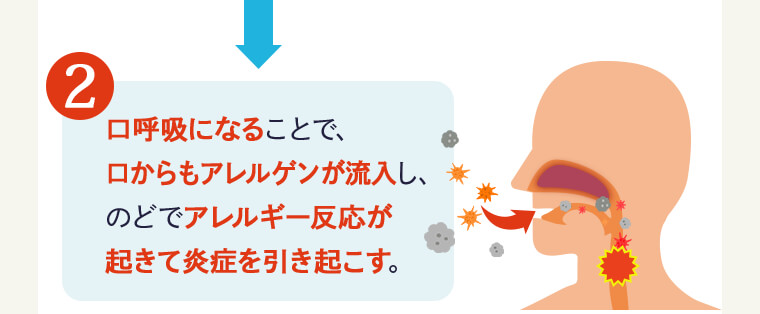 ②口呼吸になることで、口からもアレルゲンが流入し、のどでアレルギー反応が起きて炎症を引き起こす。