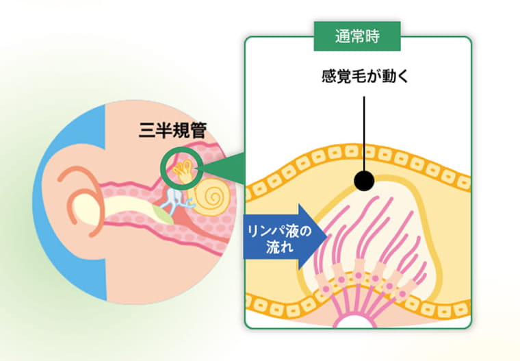 【通常時】頭を動かすと、ともにリンパ液が動いて体のバランスを感知しています（平衡機能）。